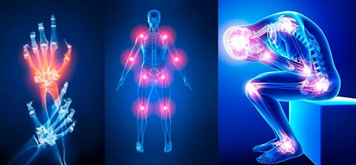 Conoce los síntomas, tipos y causas del dolor articular