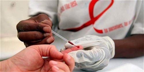 Una de cada tres personas que viven con VIH en Latinoamérica no lo sabe