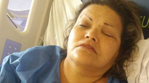 Mujer fue atacada con ácido en Guayaquil