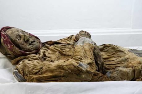 Momia de Guano, ¿el eslabón perdido de enfermedad rara en Europa?