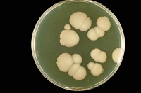 Candida auris, el misterioso hongo resistente a cualquier medicamento