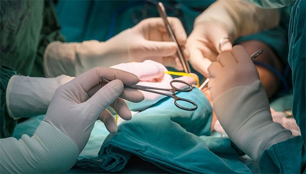MSP promueve cirugías ambulatorias de ligaduras y vasectomías