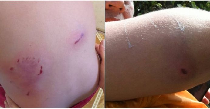 Menor de 8 años fue atacado por un pitbull en Guayaquil