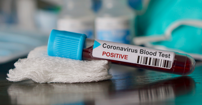 Conozca el antiinflamatorio que será utilizado en China para combatir complicaciones del coronavirus