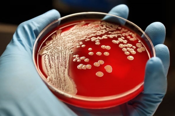 OMS emite lista de las bacterias más peligrosas del mundo