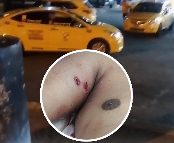 Un taxista fue herido tras intento de robo en Quevedo