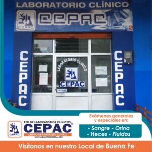 CEPAC