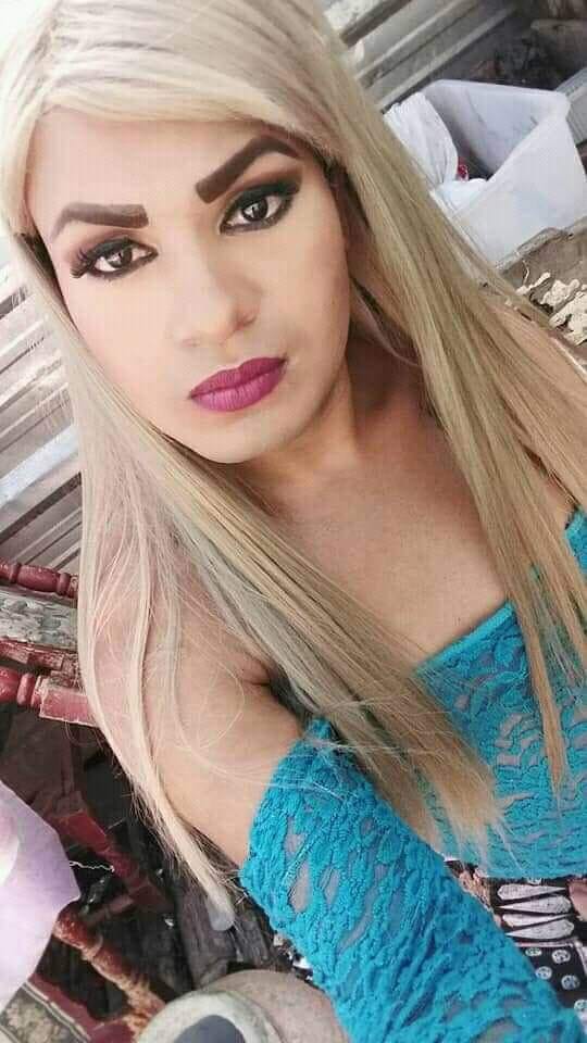 Babahoyo: Mujer trans murió por inyectarse silicona para verse más voluptuosa