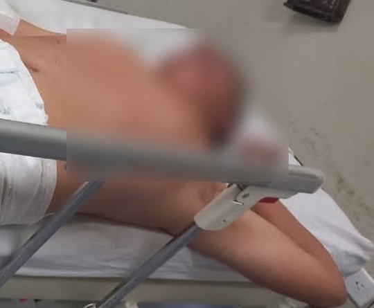 Quevedo: Hombre resultó herido por ‘balas perdidas’ en la Galo Plaza